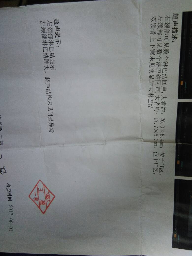 154630vlr9y6a7alzt6izy.jpg