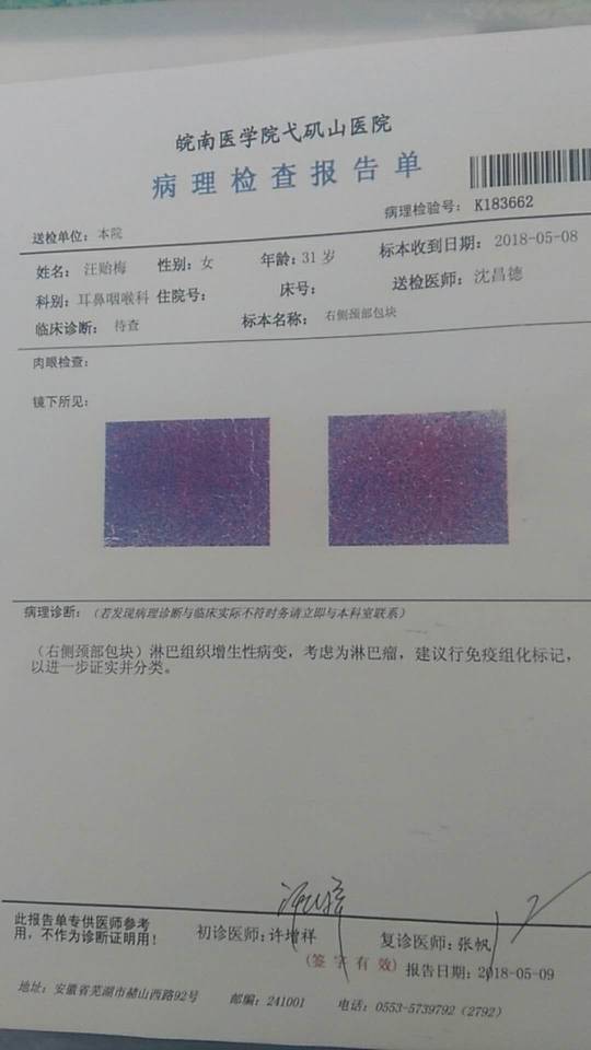 170253dkptachpgshrhs0c.jpg