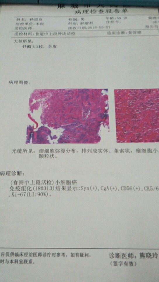 123622tcjud5zcsc55cpzs.jpg