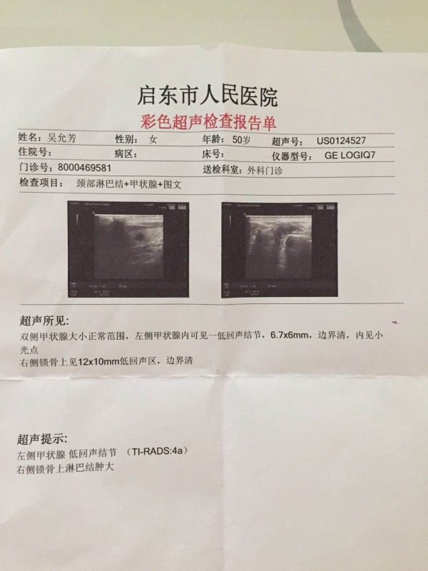 彩超报告