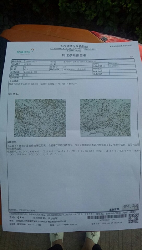 穿刺检查结果