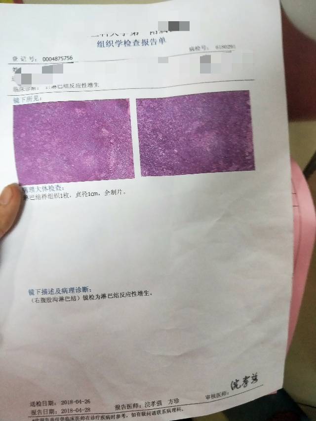 201837nk1bqpqqd21q6mpp.jpg