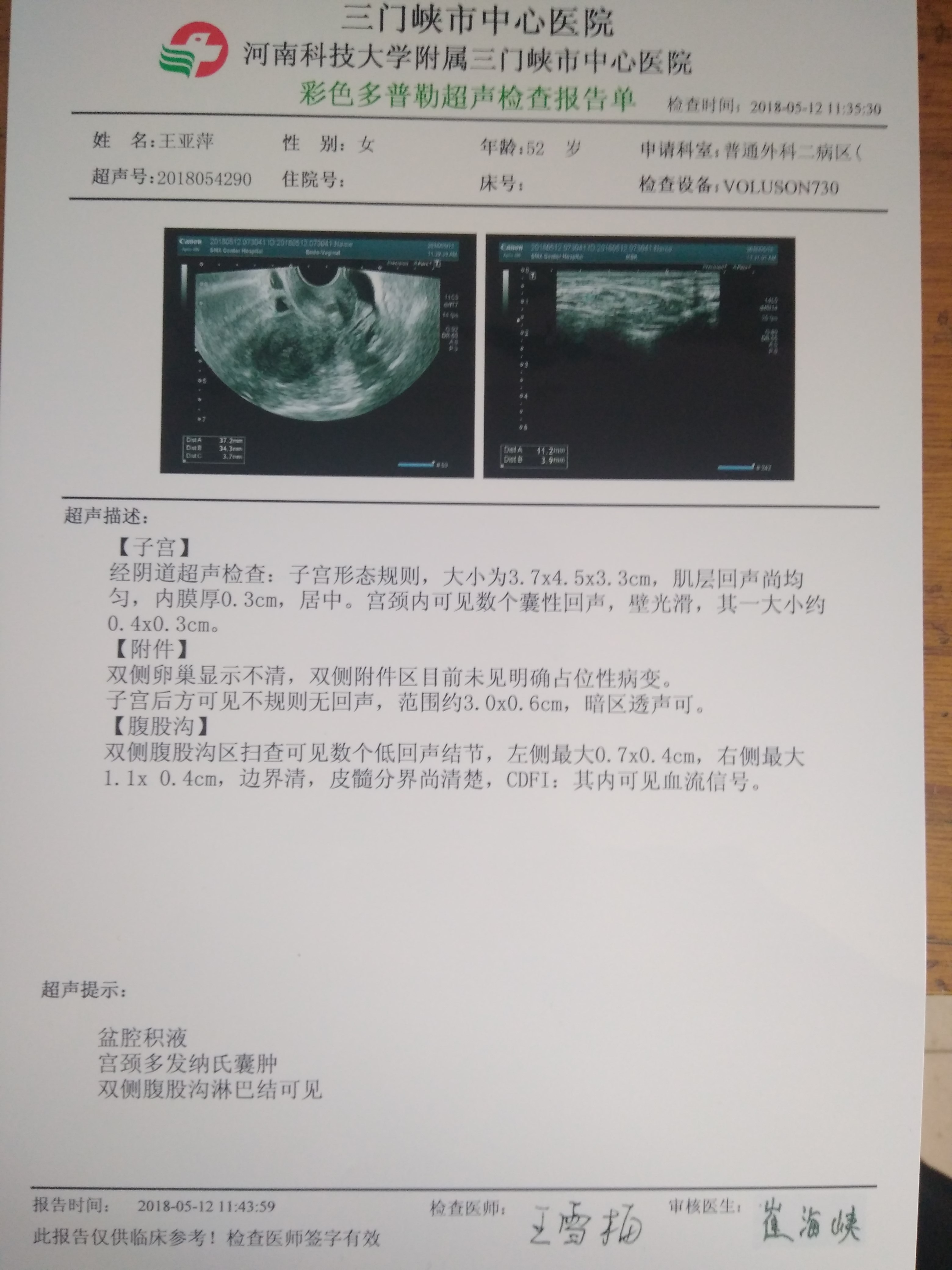 150910mhp3if4ohlyul3hl.jpg