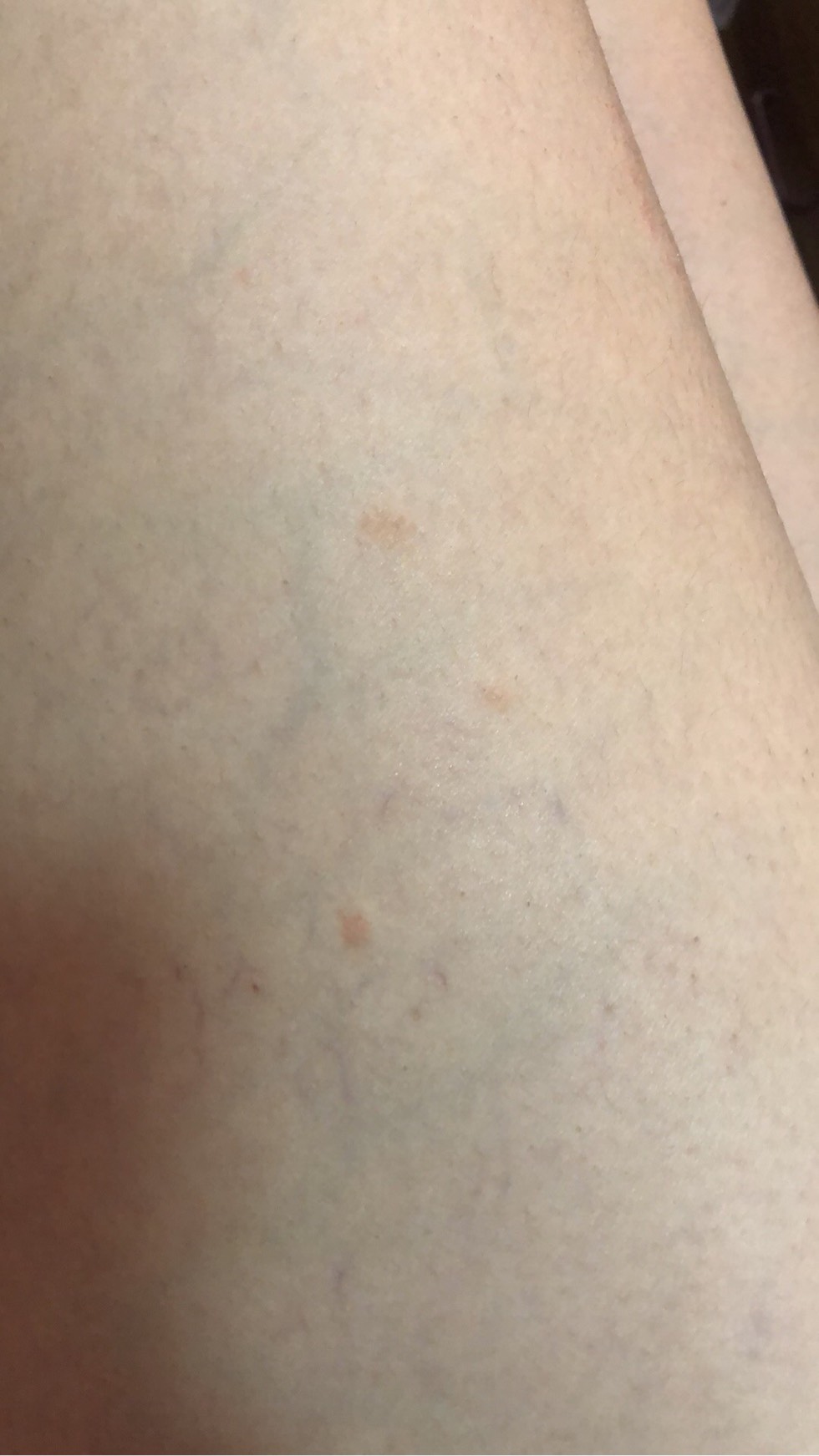 160205r6qtq05hnitj0j5y.jpg