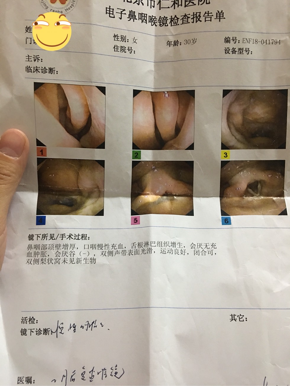 232350vq2hyozky7khggc2.jpg