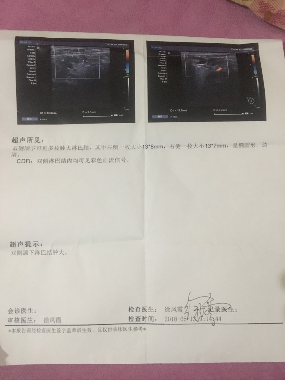 215738gvhm27jj2go2tcp2.jpg