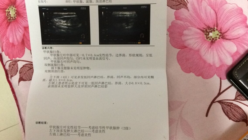 QQ图片20180515222939.jpg
