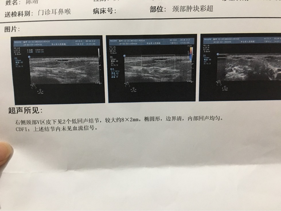 104059ec7rku74ul9lkjpb.jpg