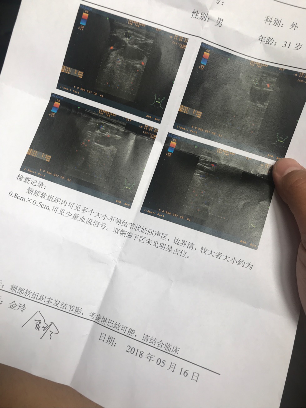 132554ec1t56c6wl635w51.jpg