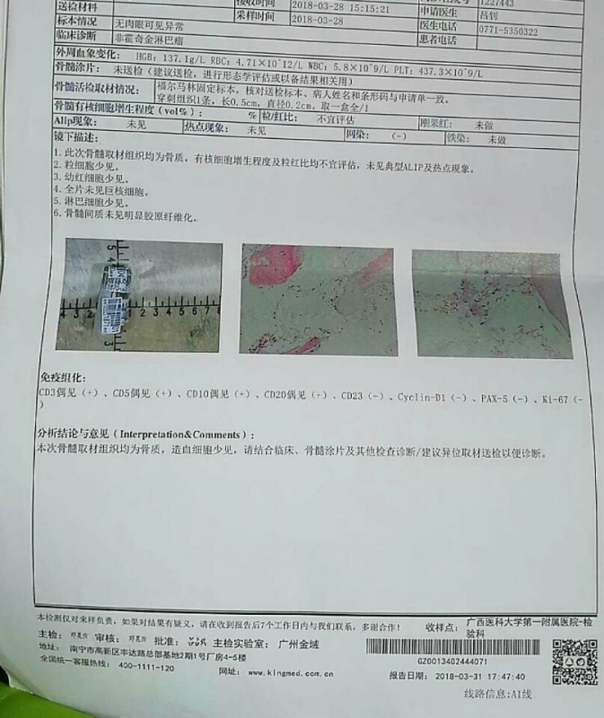 骨髓活检报告