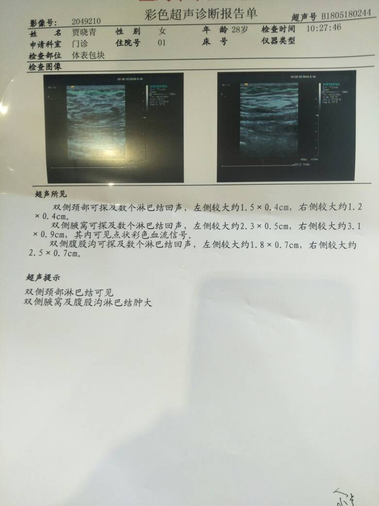 112410q9ziuazwh3hblheb.jpg