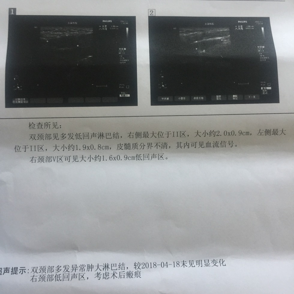 172755fkyvk6js1kh700jw.jpg
