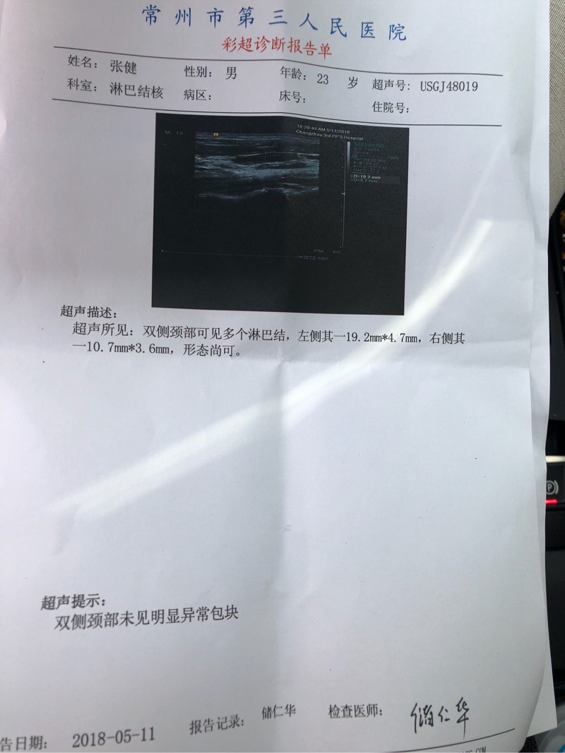 112352pryyz944eyafe1rx.jpg