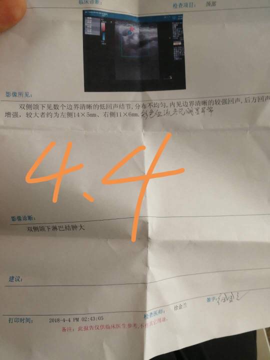 115009ujx52xdx9obh4ebi.jpg