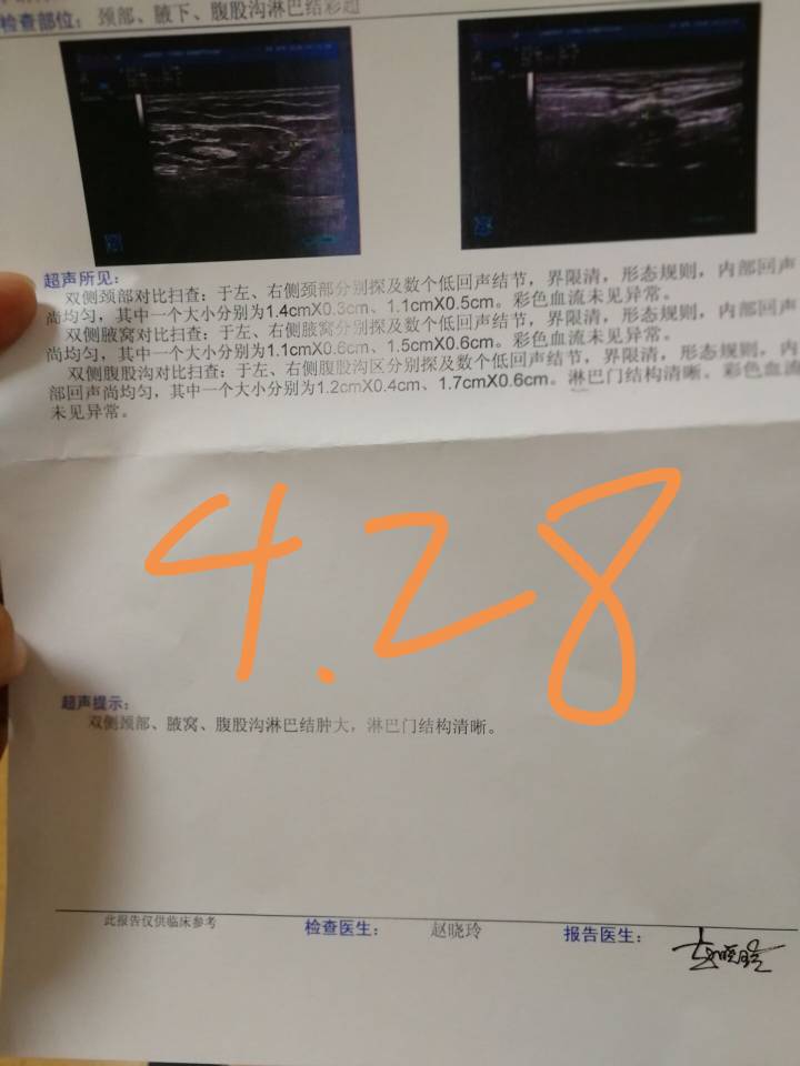 115010lhxzxmzmxhsi6eqe.jpg