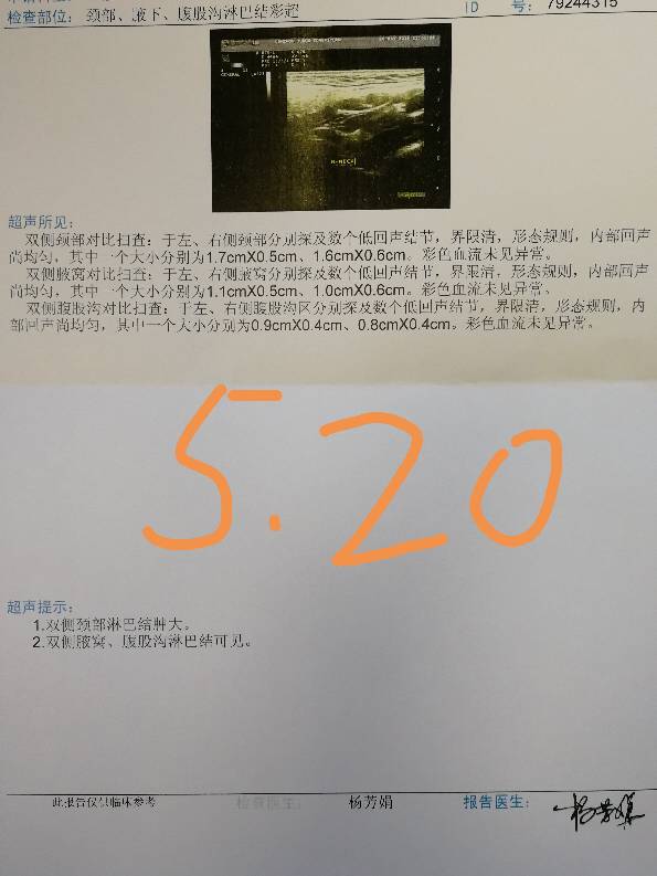 115011x5jnaz909ce95dcc.jpg