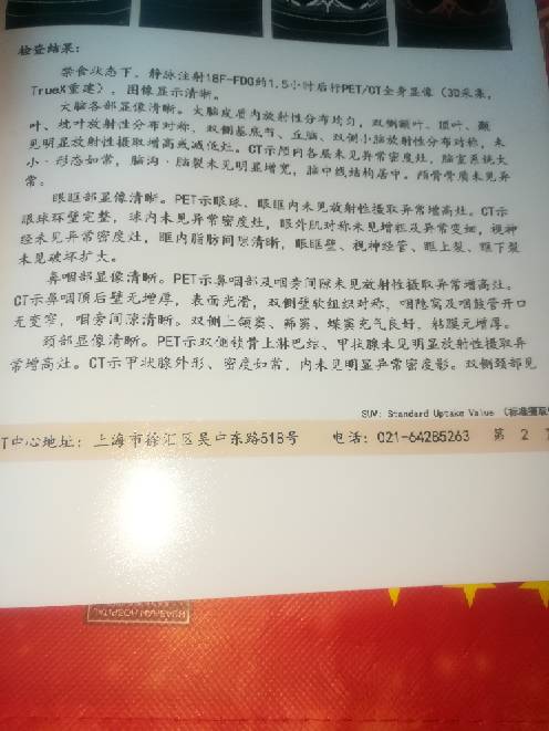221746s5iefa5ghzdkx1fo.jpg