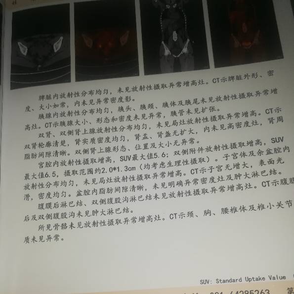 145355lw222m4dqgr2auzw.jpg