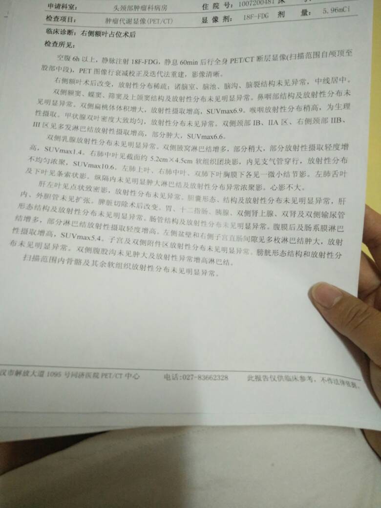 171551m73x1g6g1x63ad2c.jpg