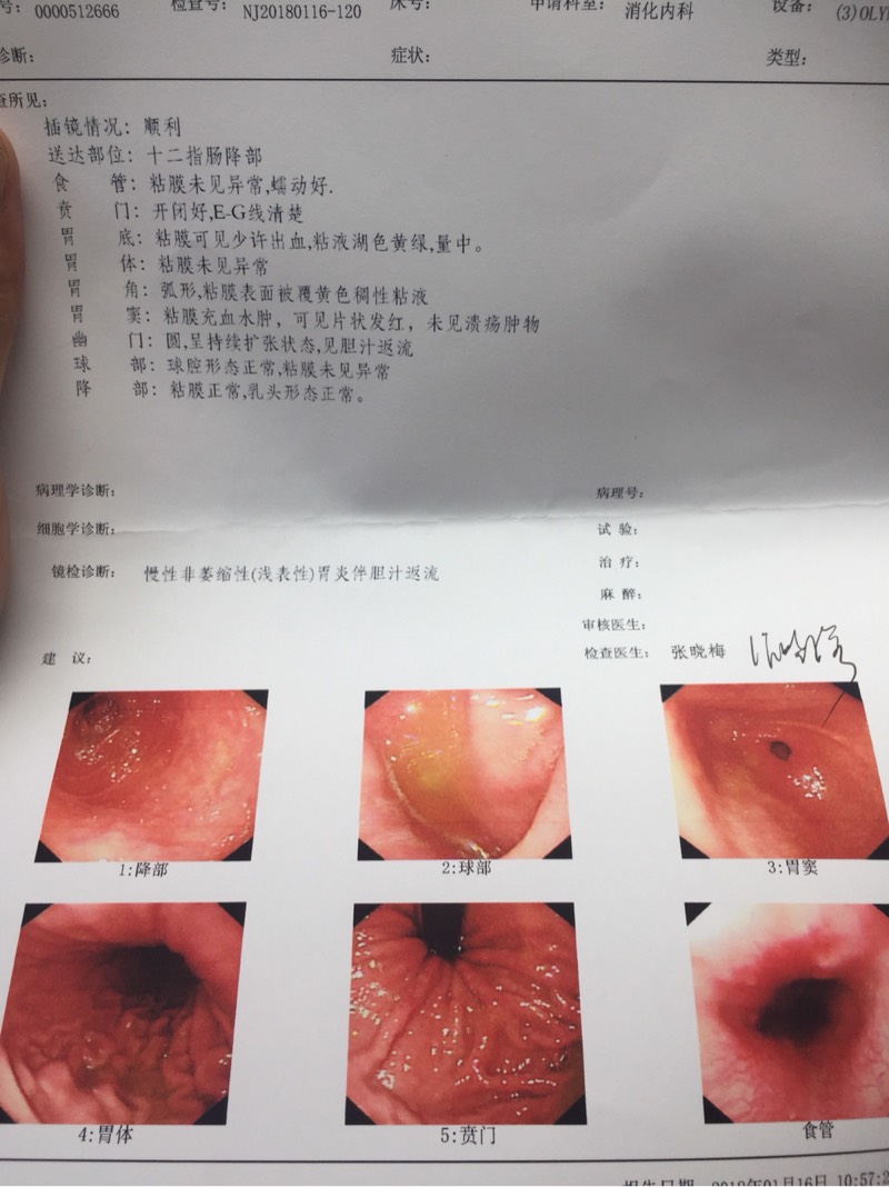141139h400r1w340ry3551.jpg