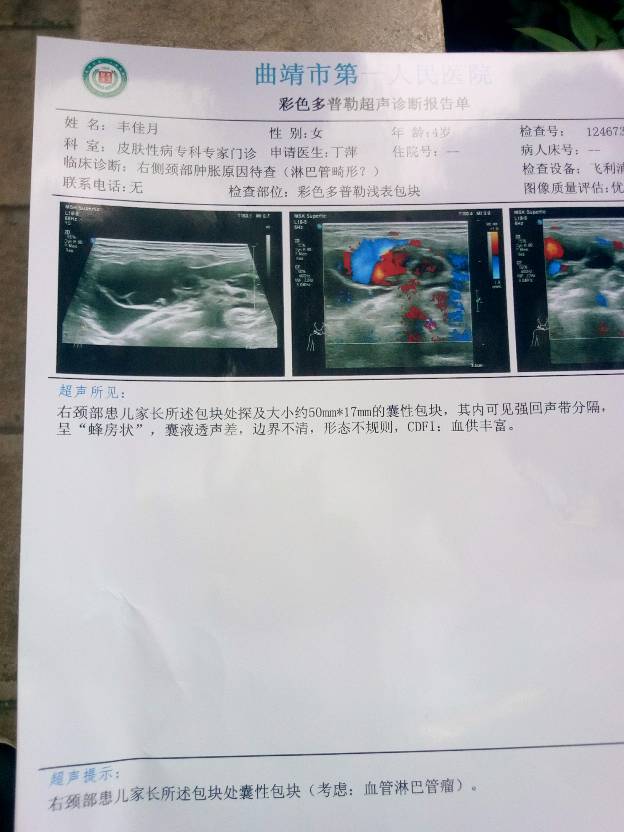 173750p15lo55l47p6r549.jpg