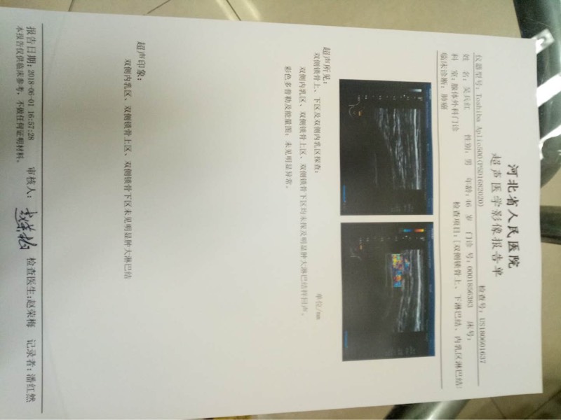 090832m1ky6nrnjlwonkpn.jpg