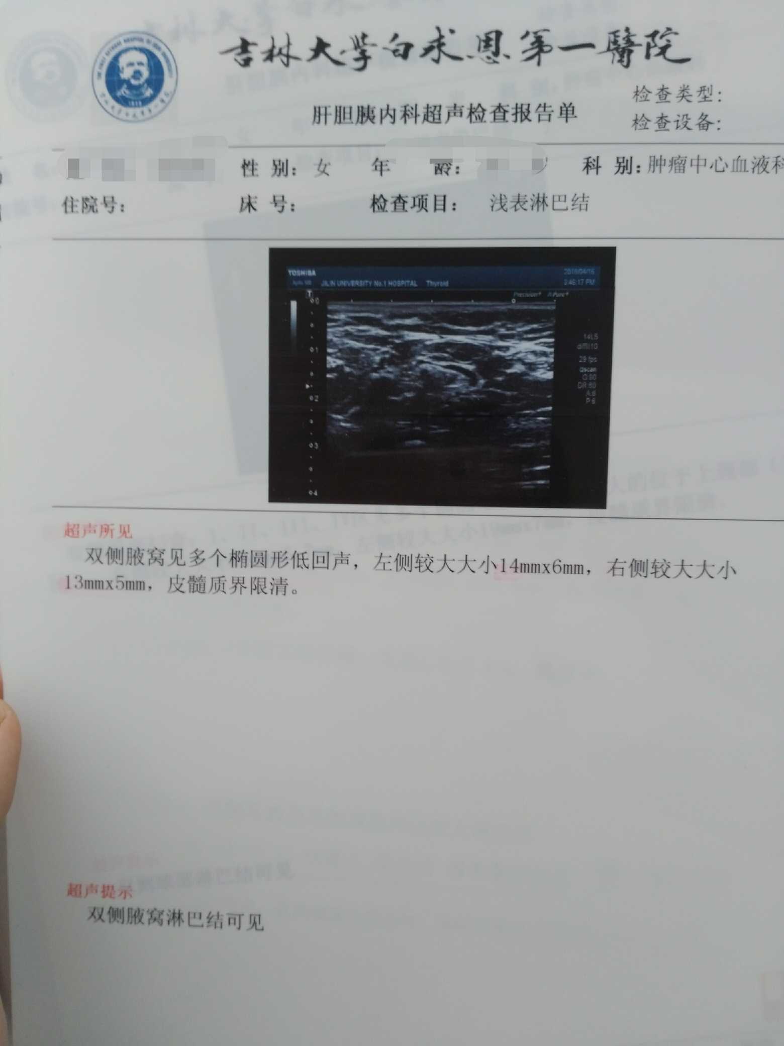 155946ni496q99i9uz9qiv.jpg
