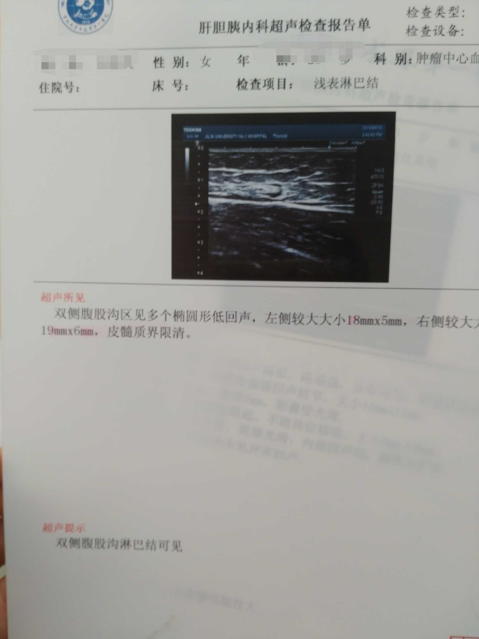 203718voq0bv88bod4b366.jpg