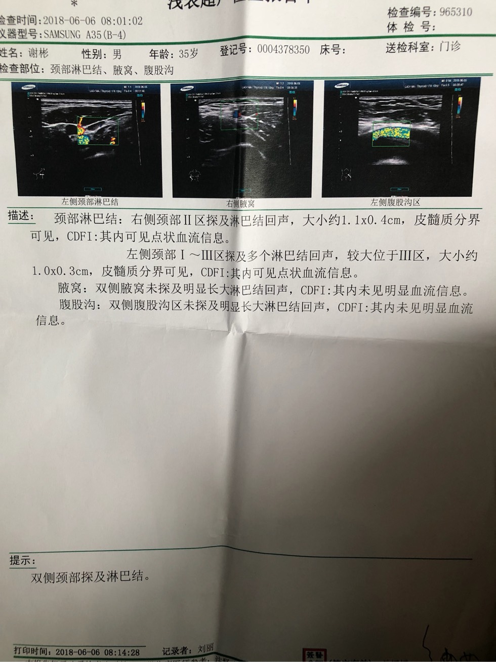 144649ht5zzwmfr2sm5ryg.jpg
