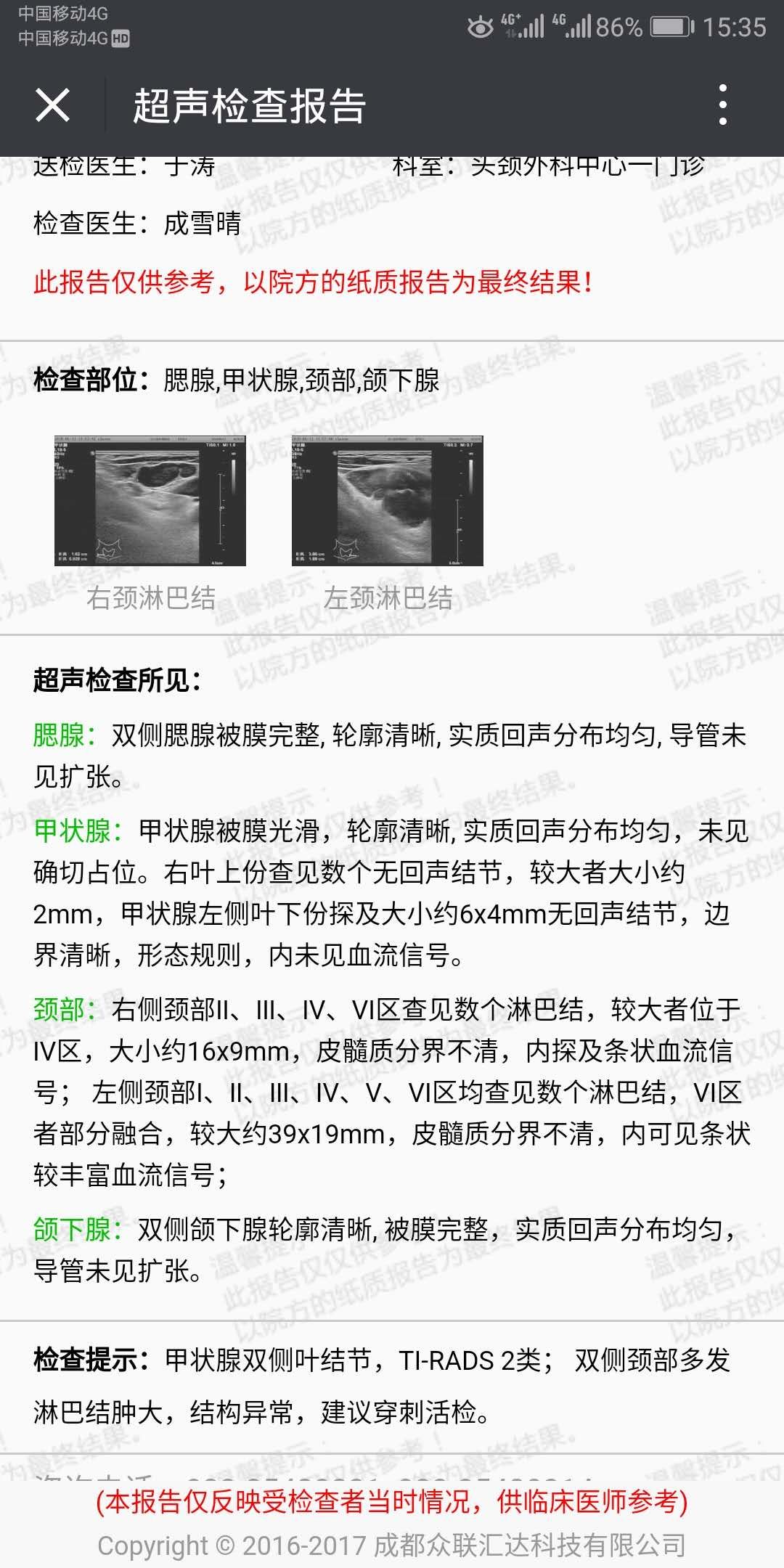 221906mpu3eny59ha9pm99.jpg