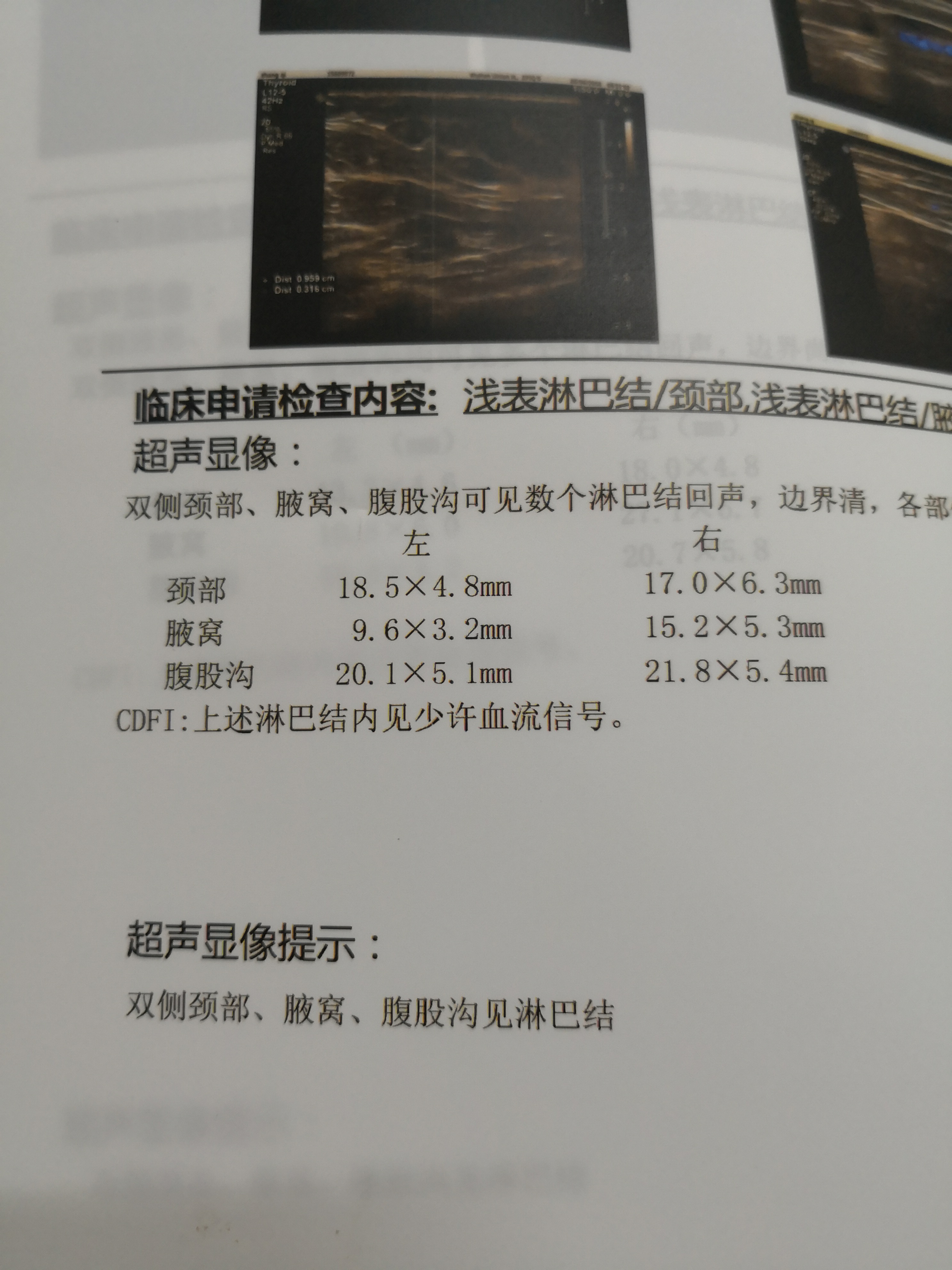 152541jv6ezqg252s682gl.jpg