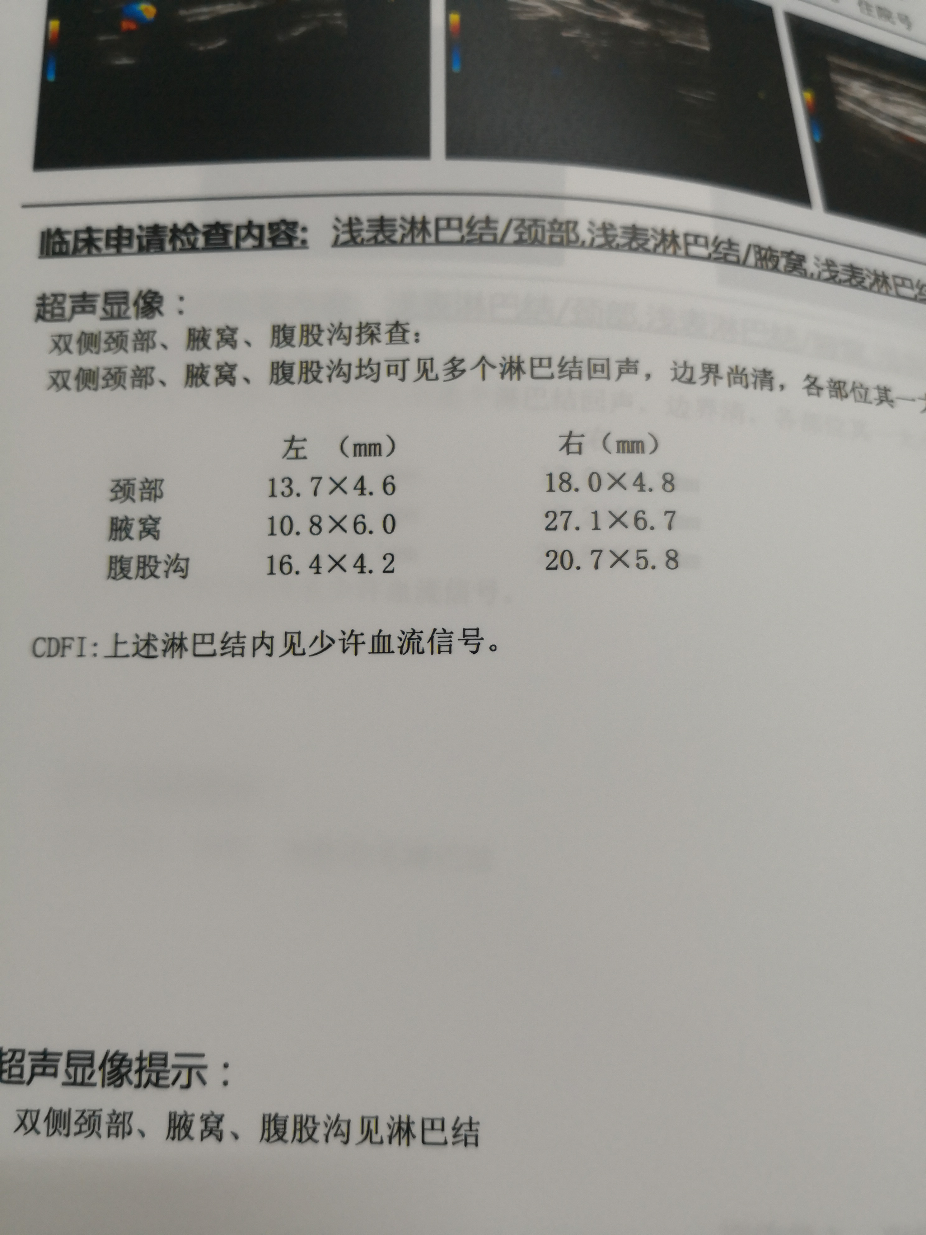 152734yn1bmke00ycrdm94.jpg