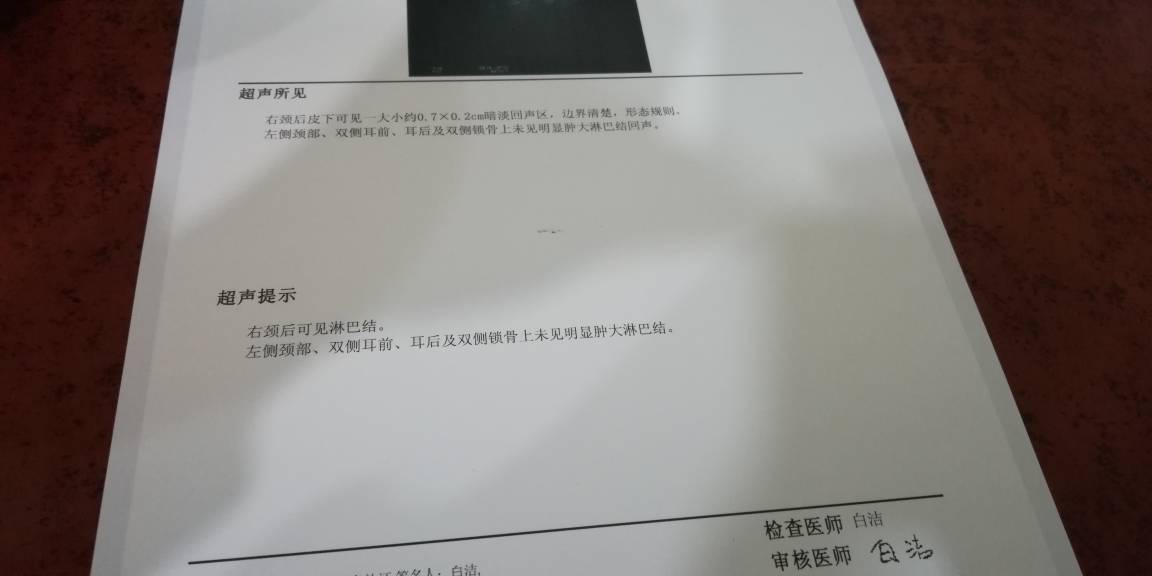 153156krwm4r11wqdbwgpi.jpg