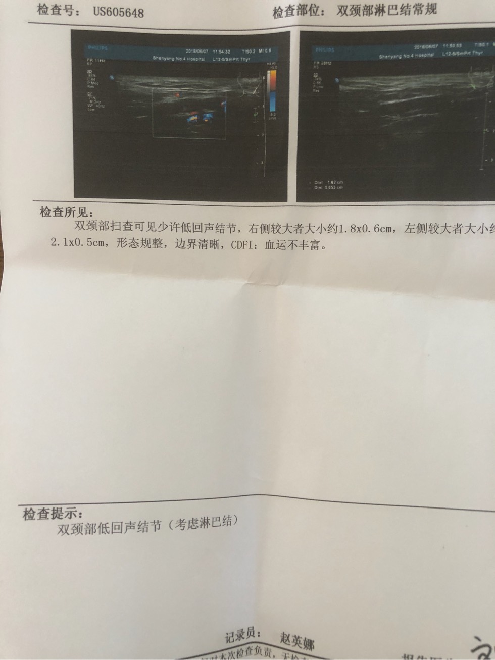 222904bfeu4q1howfjvcjf.jpg