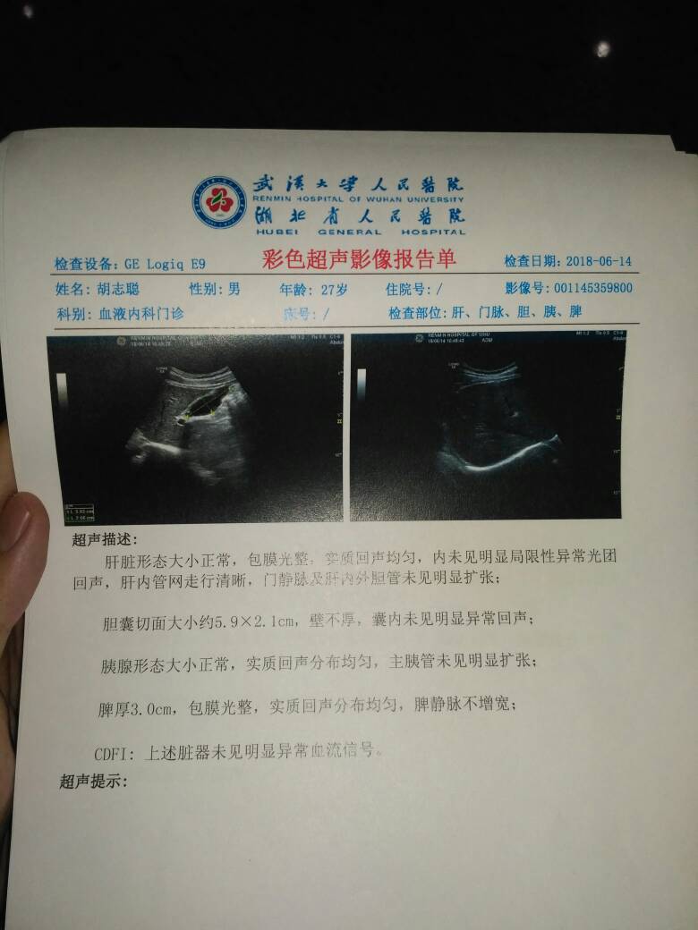 123534s5qjp2kkpjlfpdd5.jpg