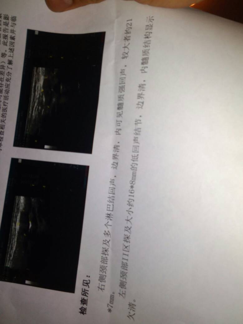 180257kz3l8nvwpvnenvlw.jpg