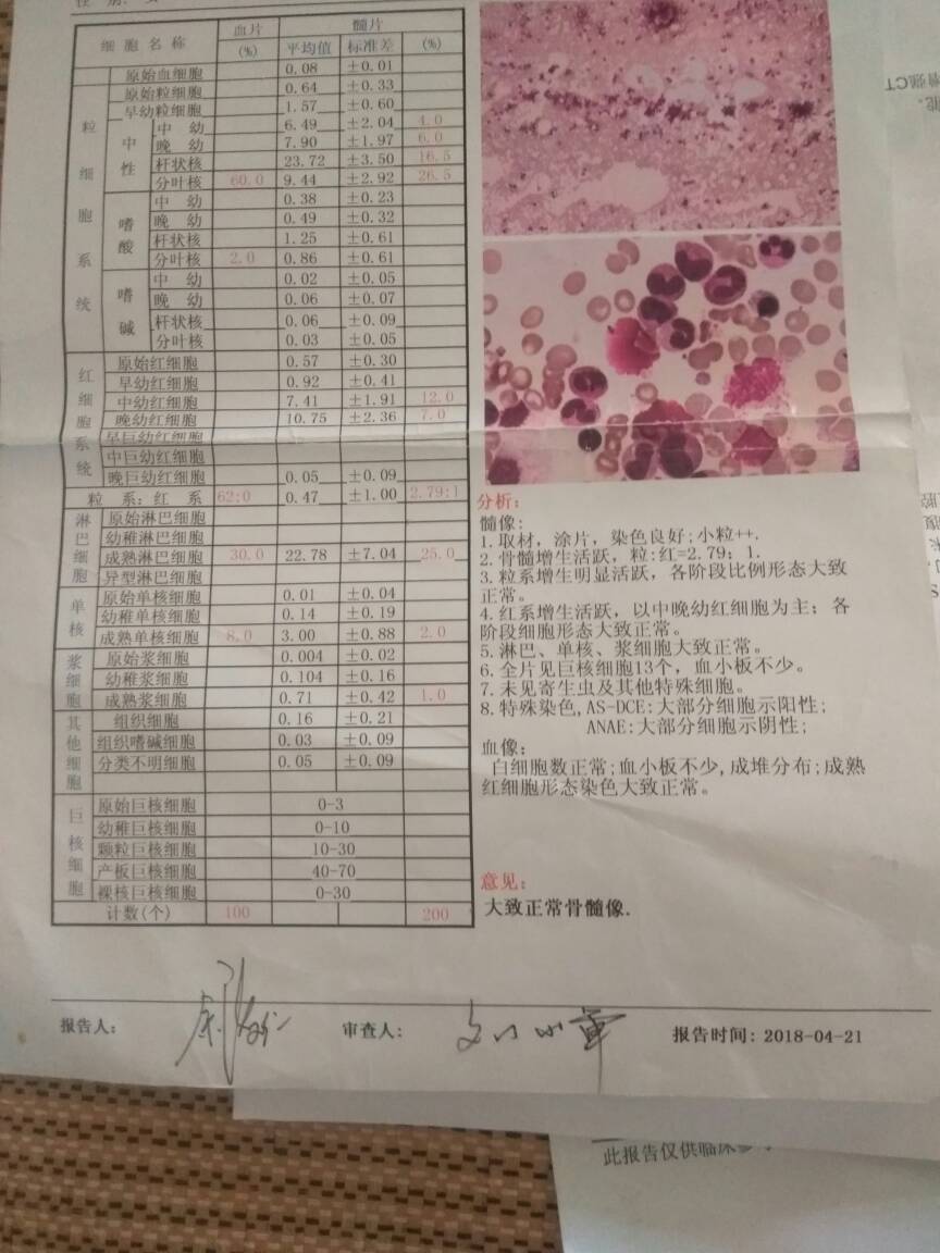 143011x8ycagll2ac86u6d.jpg
