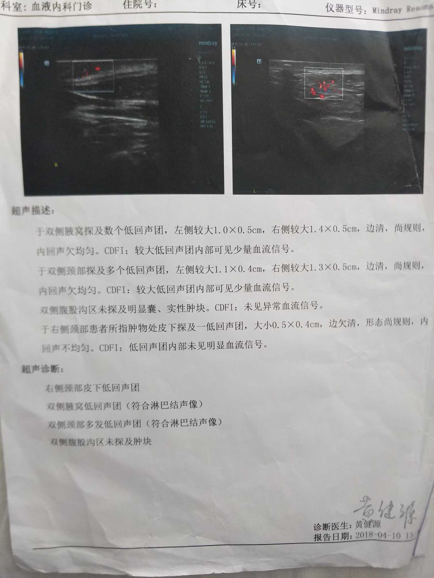 121139tk7sefua5yyi7y1a.jpg