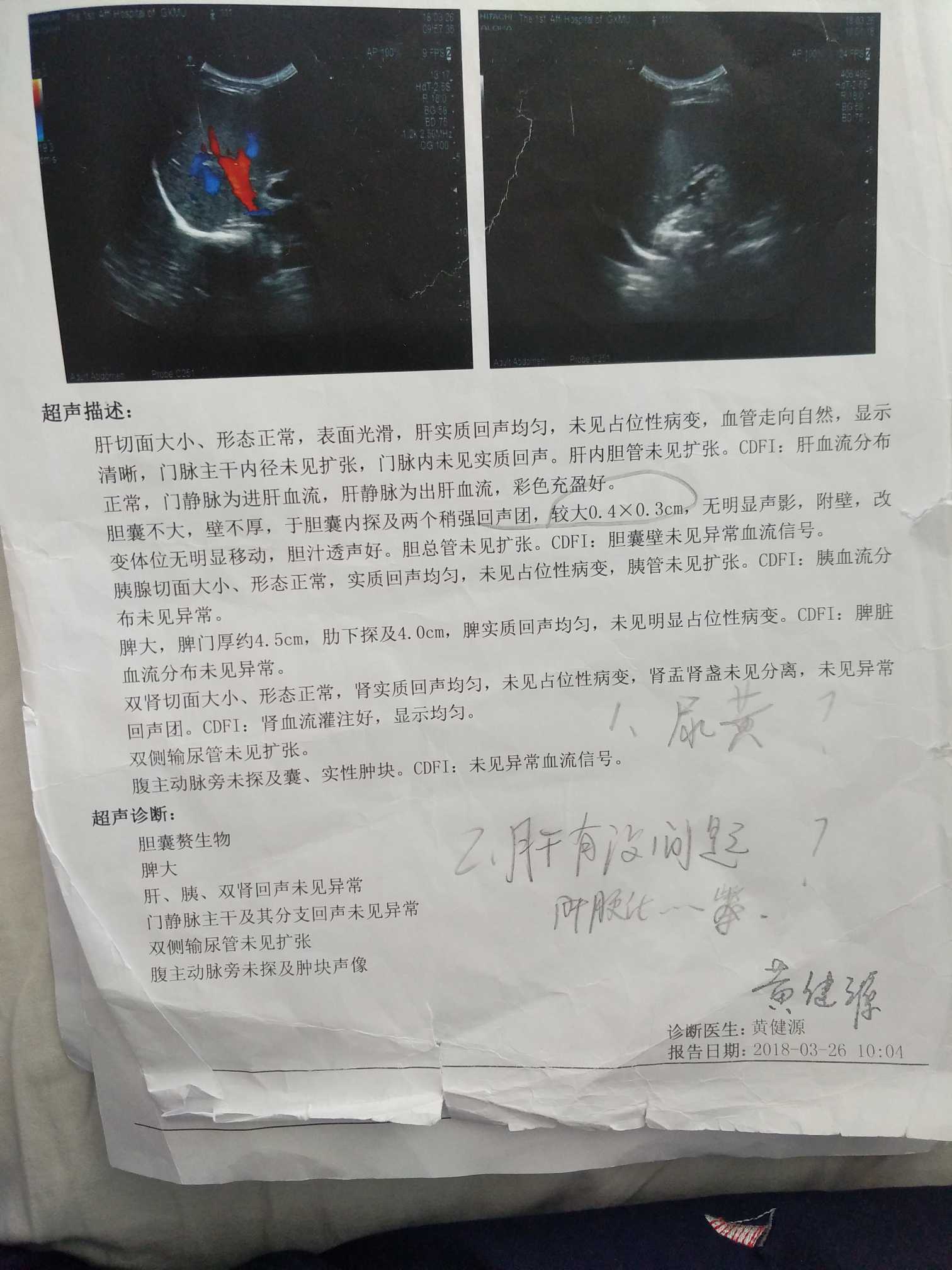 121141oymmtsbs3ya953ge.jpg