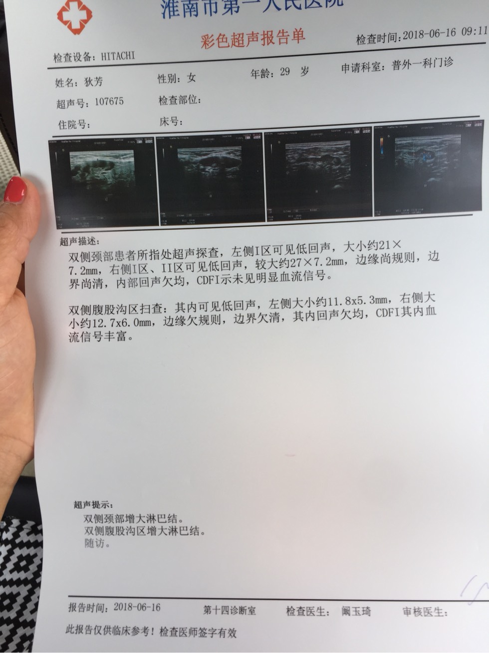 182306n3wal2lmidyq7dao.jpg
