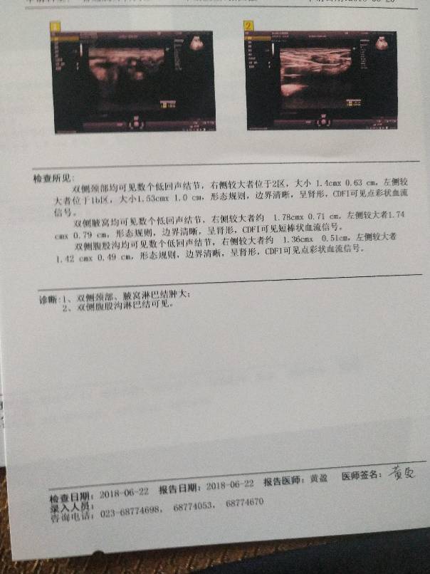 172029wsdcradr9adjtdck.jpg