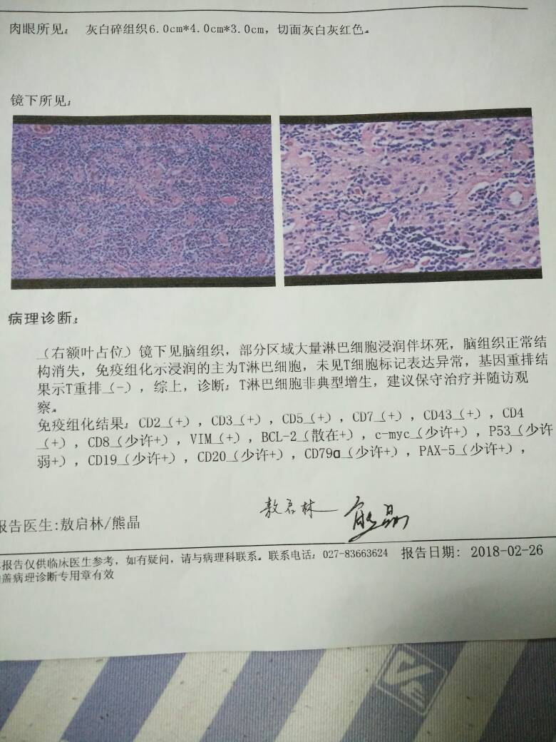 212327gb6nwu3uo6pw16m6.jpg