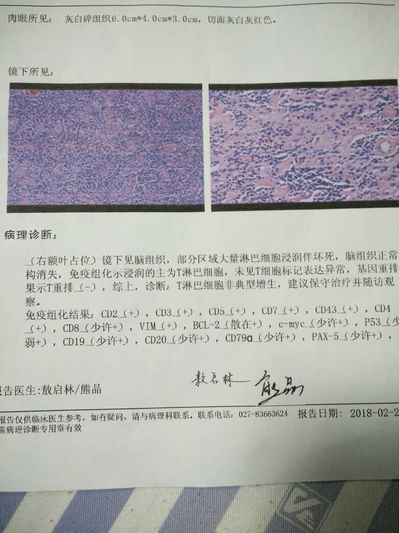 212329dmvq7emdm227cqkv.jpg