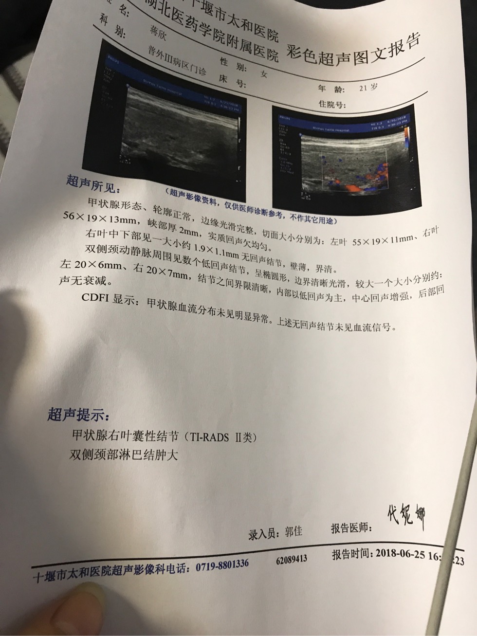 200511ts3g33fzbwa3wmc0.jpg