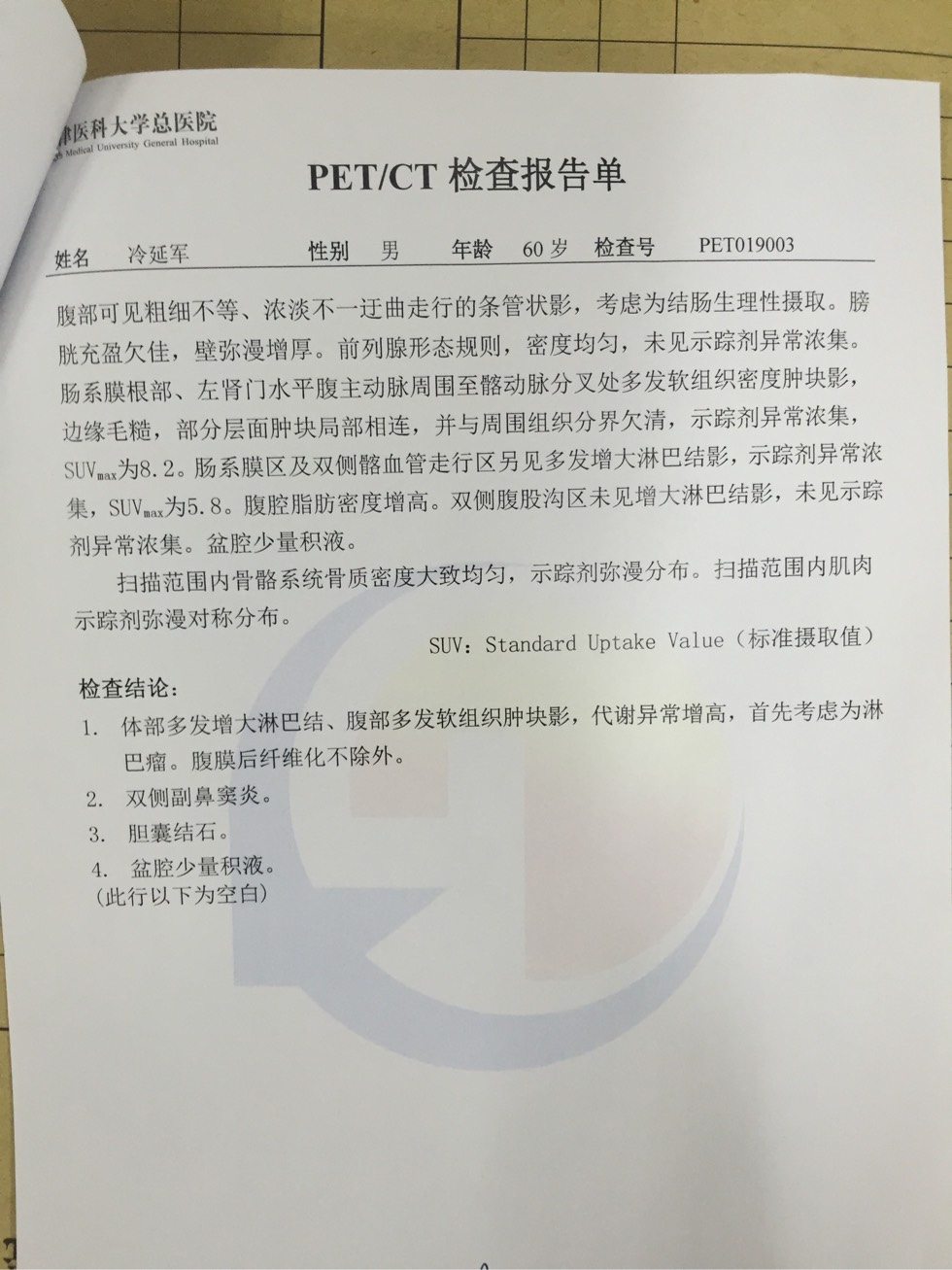 082137hqpfpt1q47qat86z.jpg
