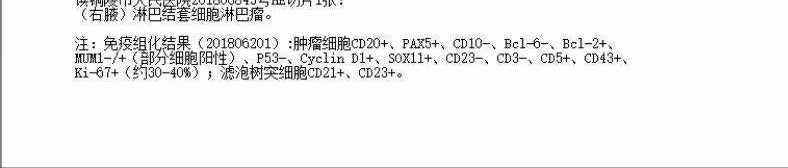 120500i6ajt4alvcbnxj6p.jpg