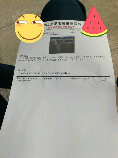 124248nzr2uh4ipufe2wp2.png