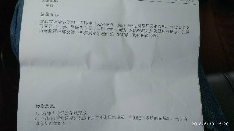 202325qpx89s9pt1ab91sb.jpg