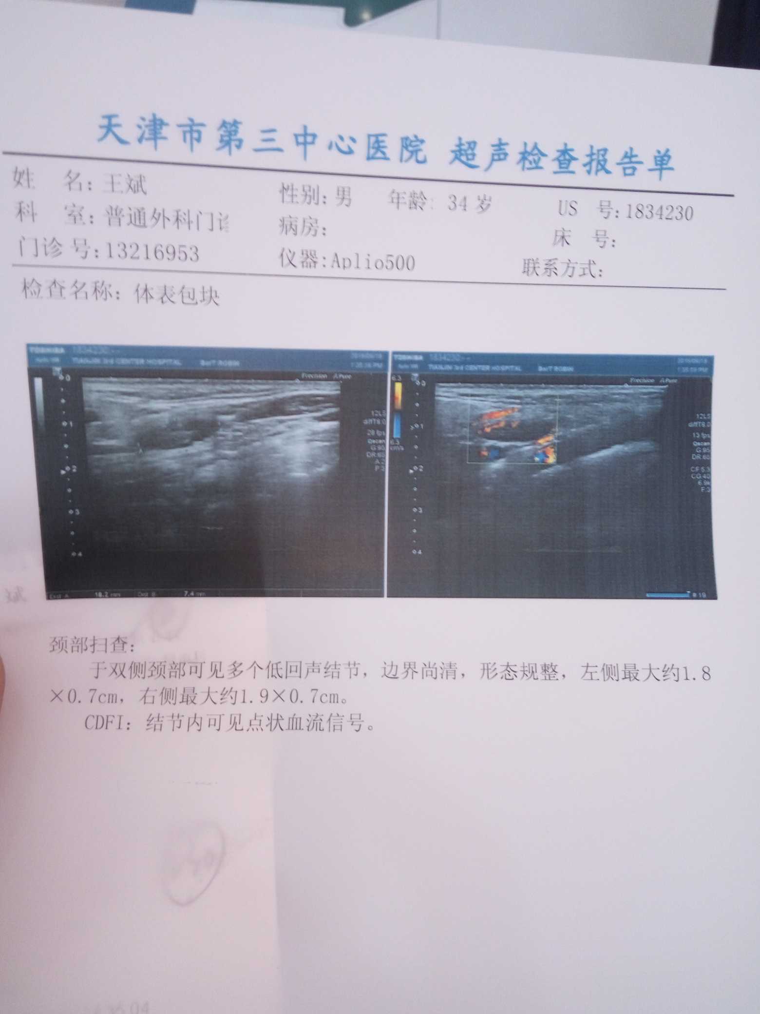 084125ww75c7izmh5s7efi.jpg