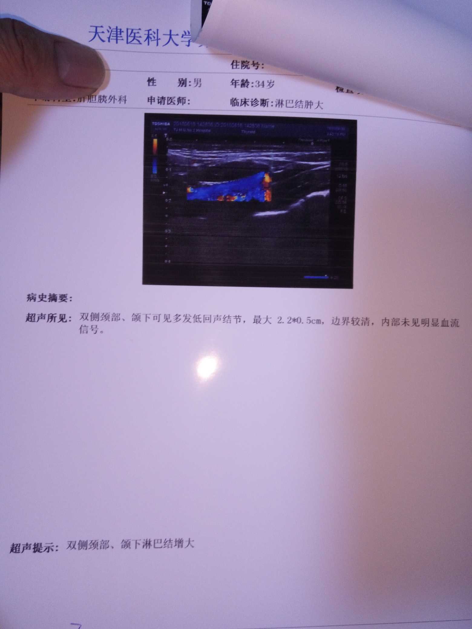 084126tz6n6slf9x6x7hx8.jpg